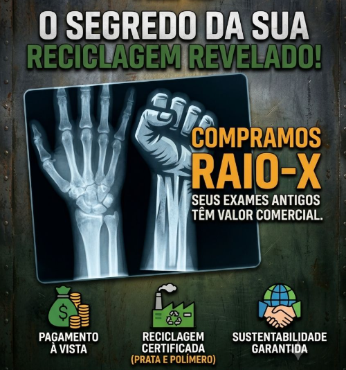 RAIO -X 